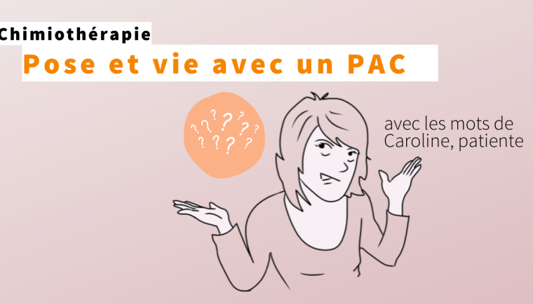Pose et vie avec un PAC, le vécu d'une patiente