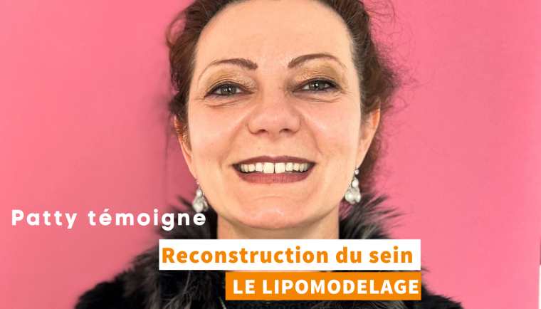 Reconstruction du sein par lipomodelage, Patty témoigne